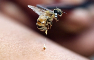 علاجات سم النحل