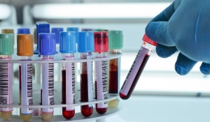 هل فحص الدم العادي يُظهر وجود سرطان في الجسم؟