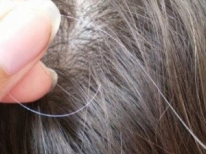 كيف تحاربين شيب الشعر بوصفات طبيعية ؟