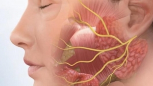 العصب السابع او الشلل الوجهي